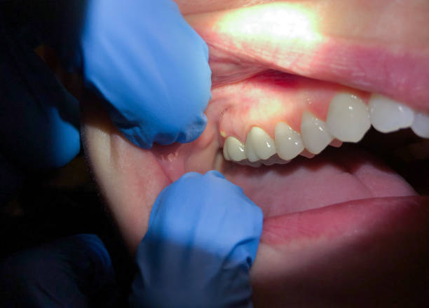 Best Broken or Cracked Tooth Emergency Dentist in South Portland, ME